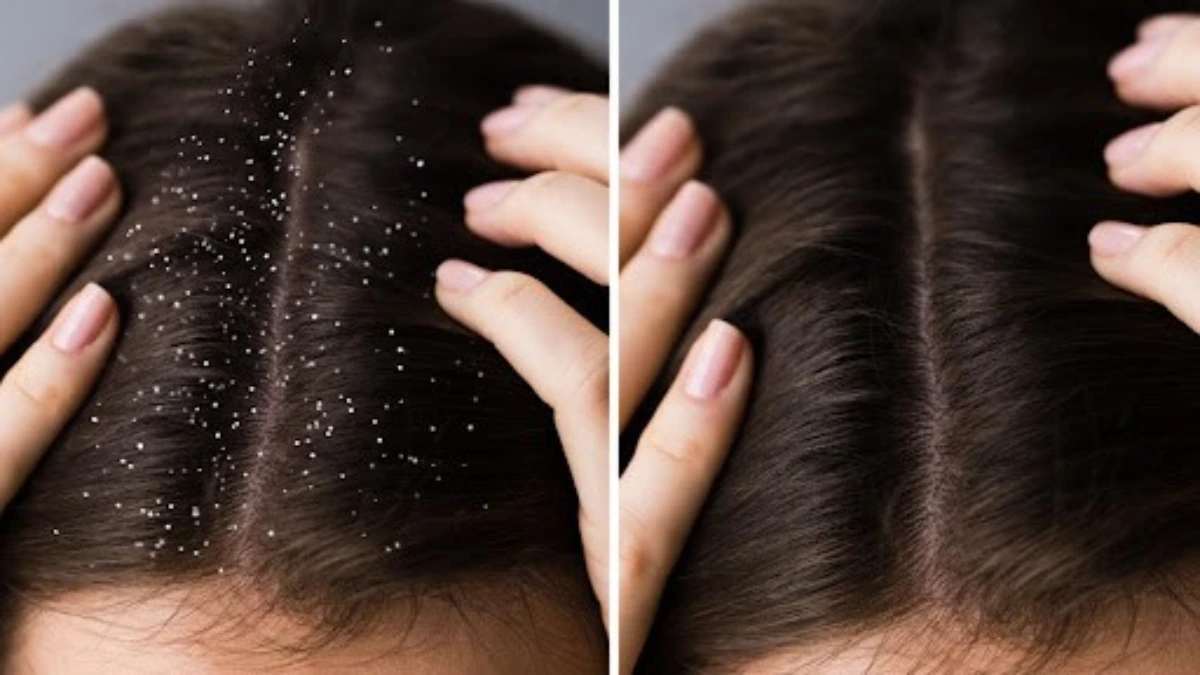 Hydra Facial