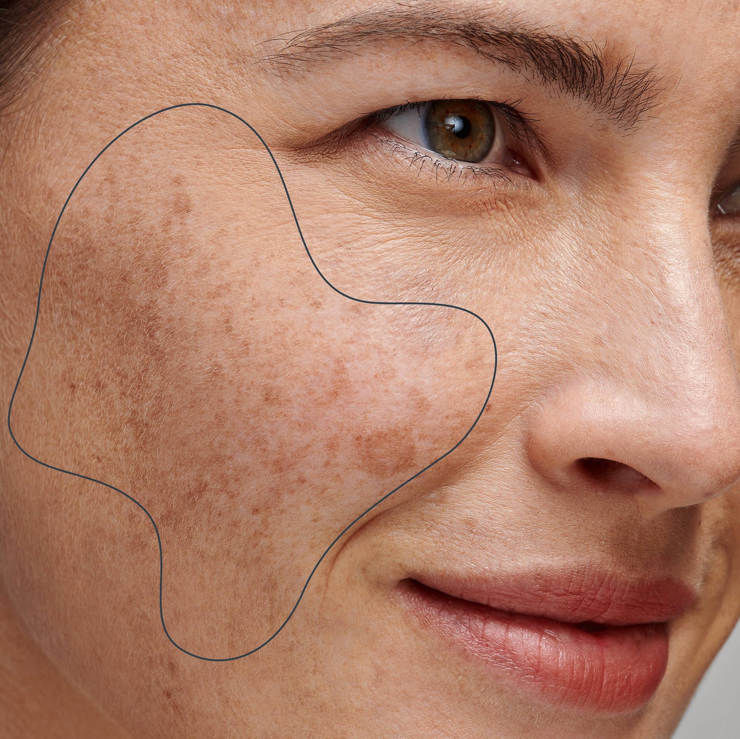 Hydra Facial